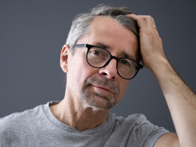 Nine hard truths about going bald
